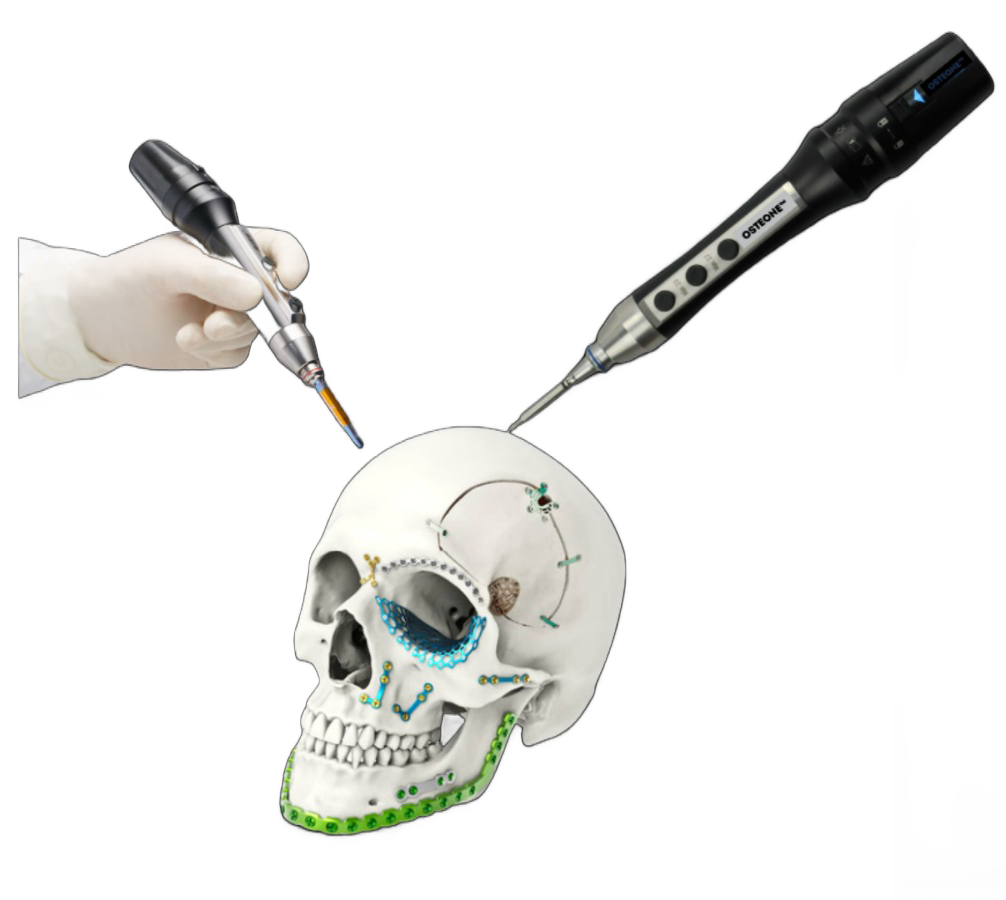 OsteOne™ System (Electric Driver & Screw Feeder Attachment)